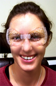 lasik after immediately