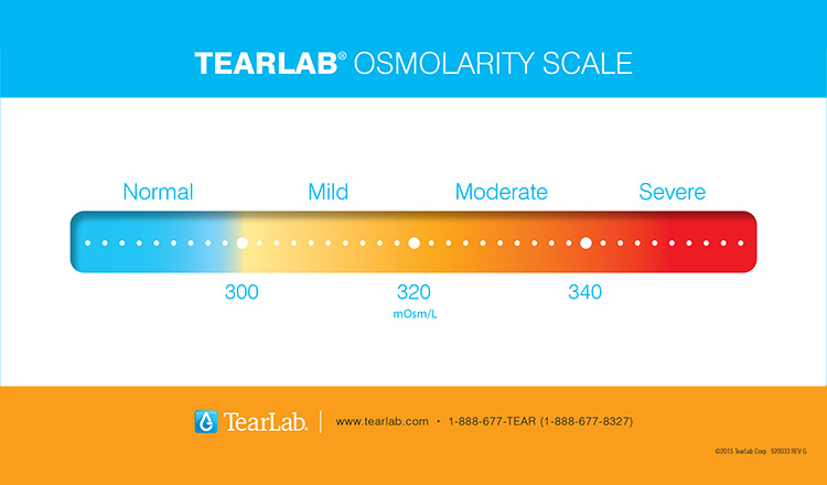 dry eye Chicago and Oak lawn IL